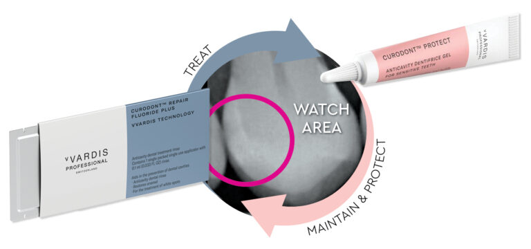 An infographic for vVardis Professional dental products showing a circular workflow around a tooth x-ray labeled Watch Area. A blue arrow labeled Treat points to a Curodont Repair package, and a pink arrow labeled Maintain and Protect points to a tube of Curodont Protect gel.